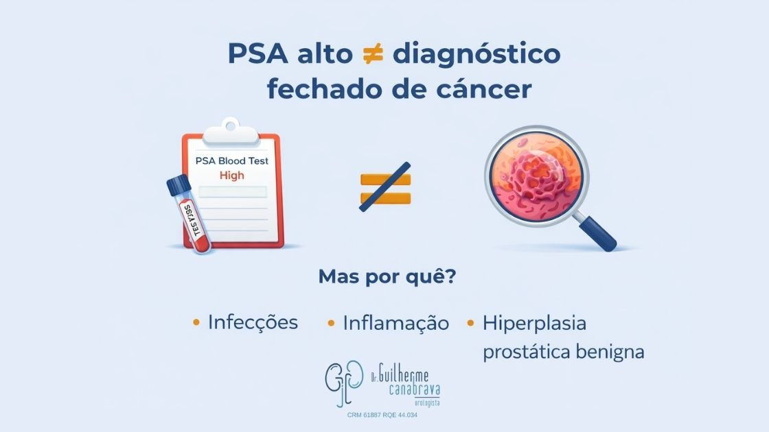 PSA alto diferente de diagnóstico fechado de câncer