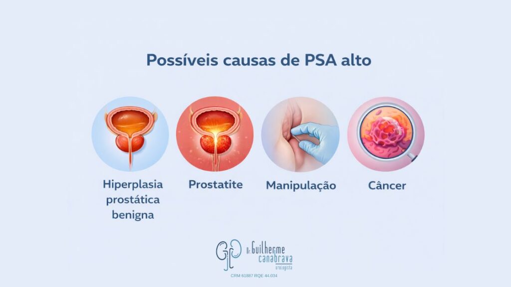 nfográfico com possíveis causas de PSA alto