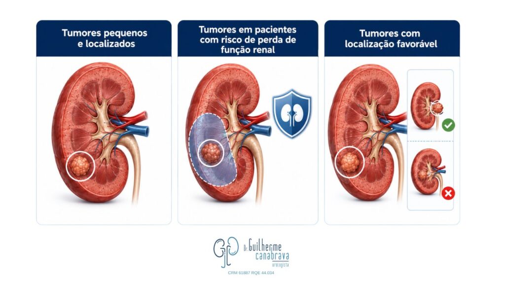 nefrectomia parcial para retirada de tumor no rim