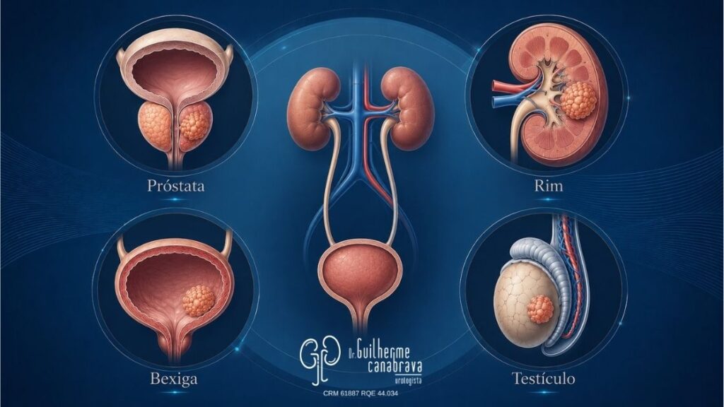 tumores-urologicos-prostata-rim-bexiga-testiculo