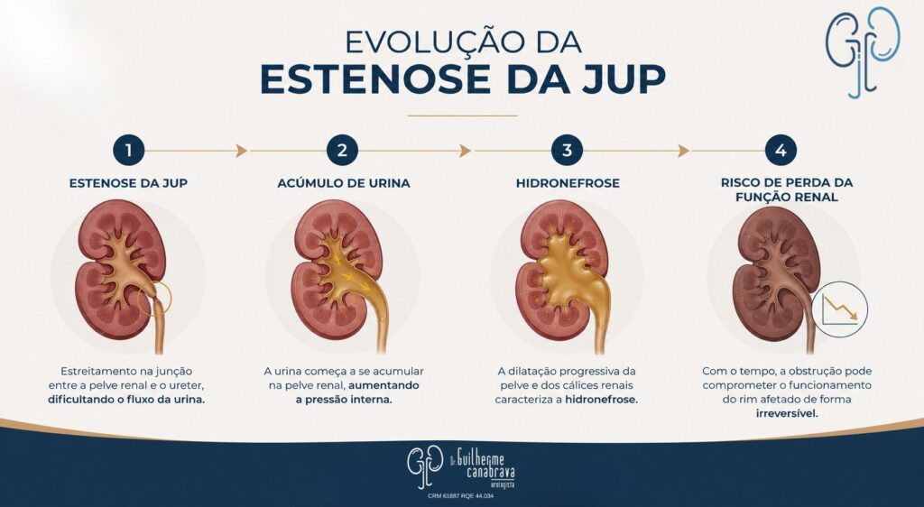 Evolução da estenose da JUP para hidronefrose e perda de função renal