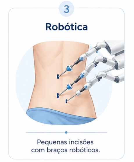 Pieloplastia robótica