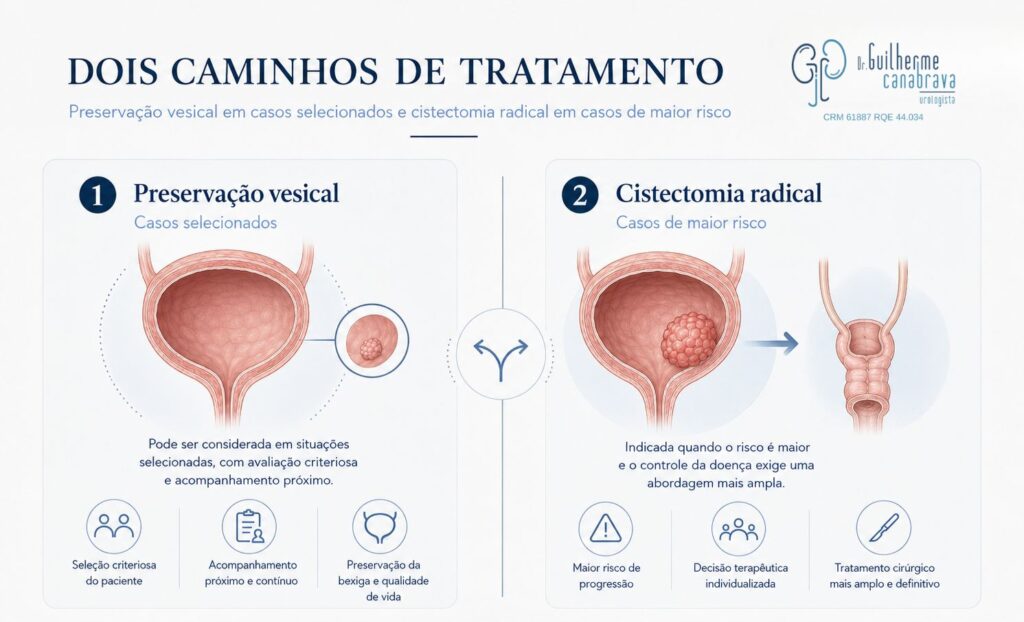 tratamento com preservação da bexiga ou cistectomia radical no câncer de bexiga