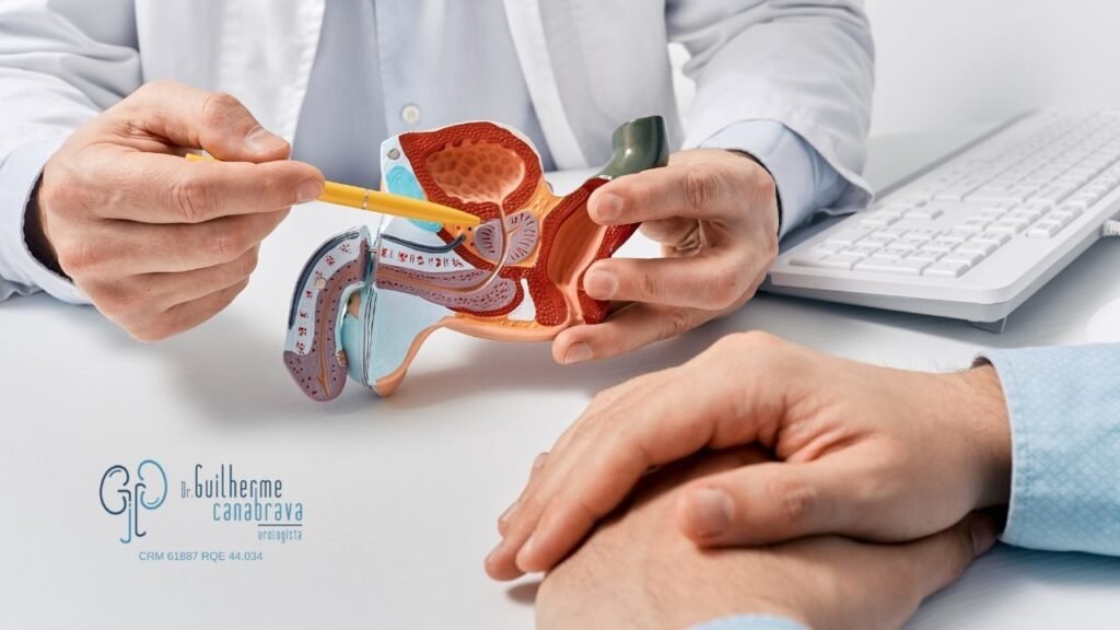 Ilustração da próstata, bexiga e uretra explicando o que acontece se o homem retira a prostata