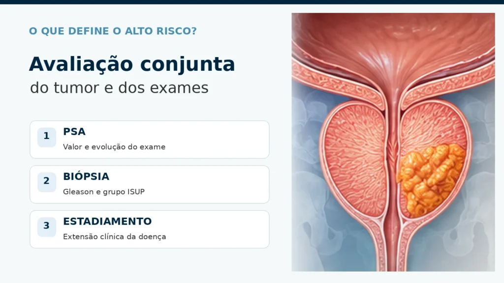 Fatores do câncer de próstata de alto risco 